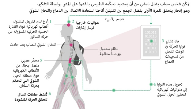 اختراق طبي .. تقنية جديدة تمكن مصابا بالشلل النصفي من المشي