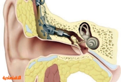التهابات الأذن المتكررة قد تسبب الصمم والكشف يتم بالمنظار صحيفة الاقتصادية