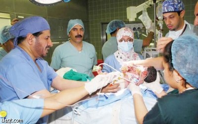 نجاح عملية فصل طارئة لسياميتين من البحرين بعد ولادتهما مباشرة