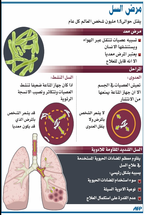 زيت السمك يمنع فقدان البصر المرتبط بالتقدم في العمر